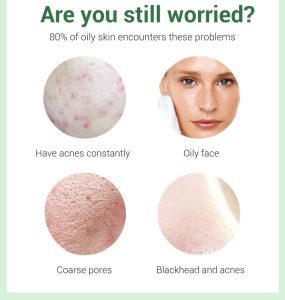 Acne Care Treatment