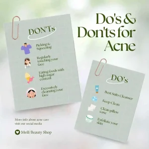 Cause of Acne: What to do and not to do