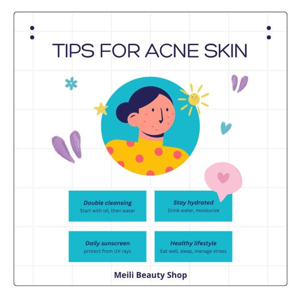 Tips for Acne Skin