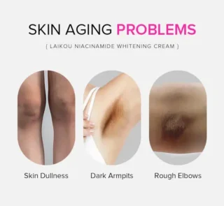 Laikou Niacinamide Whitening Cream Lighten Spots – 100g