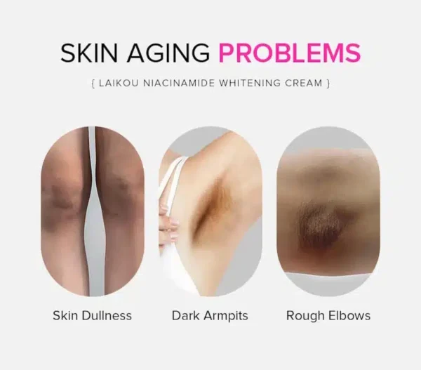 Laikou Niacinamide Whitening Cream Lighten Spots – 100g