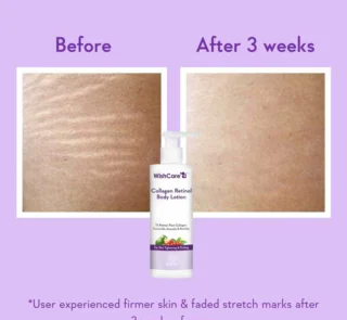 WishCare Collagen Retinol Body Lotion 200ml